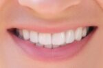 白く美しい歯の口元