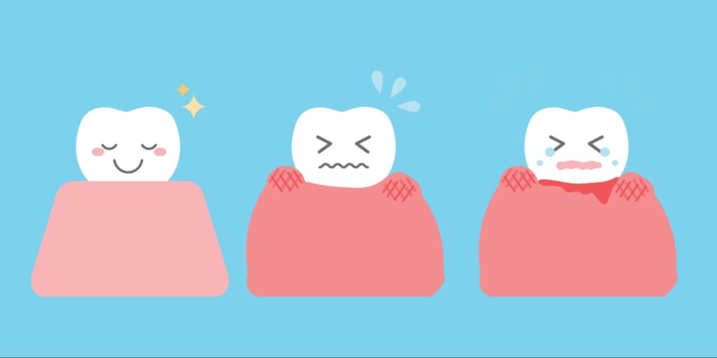 健康な歯と炎症を起こした歯茎のイラスト