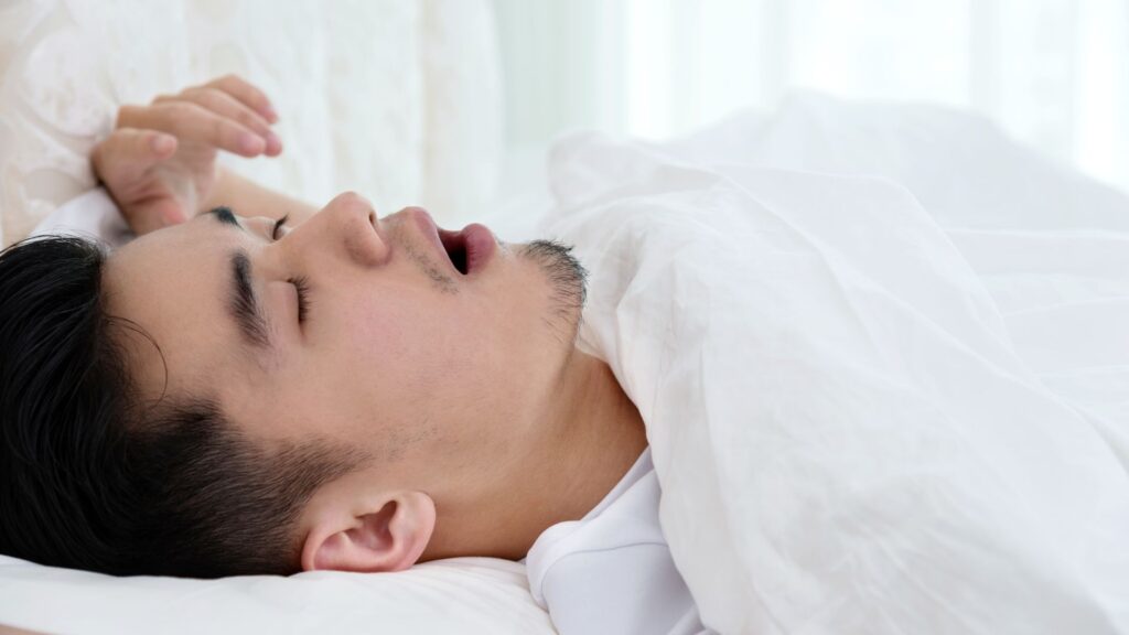 口を開けていびきをかいて寝ている睡眠時無呼吸症候群の男性