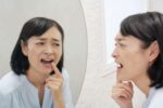 歯が欠けた　痛くない