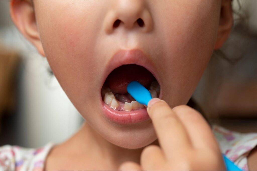 子ども 歯並び 自然に治る