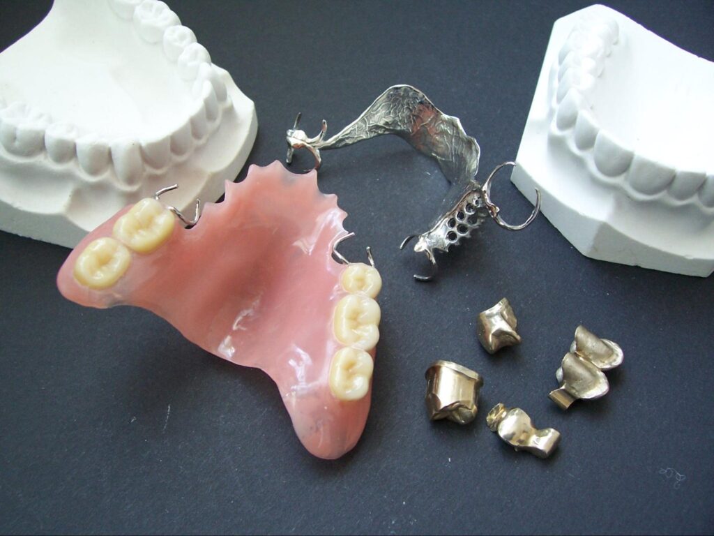 歯医者 被せ物 やり直し 費用