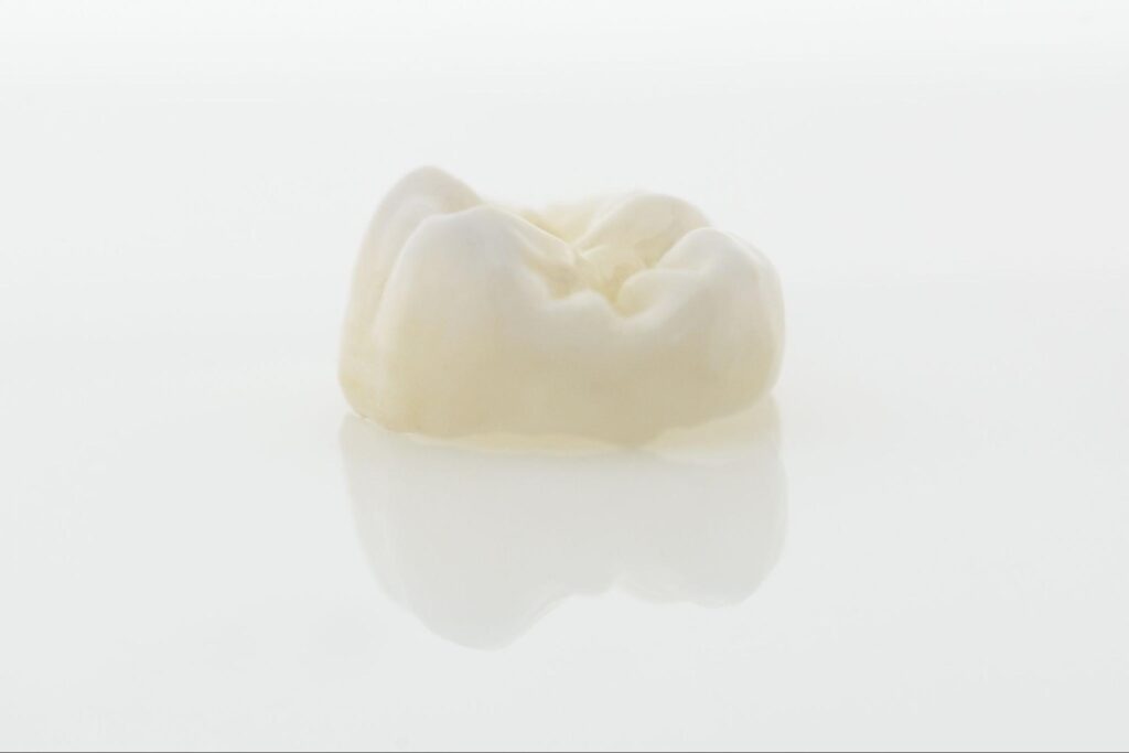 歯 被せ物 種類 おすすめ