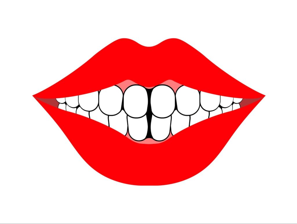 前歯 隙間があいてきた 原因