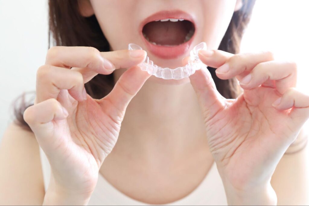 前歯 隙間があいてきた 原因